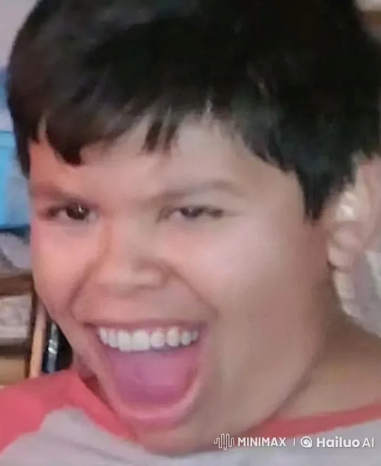 Boy Surprised by Playful Dog Biting His Arm – AI Generated Video | Hailuo AI