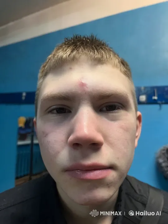 Close-up of Young Person with Spiked Hair – AI Generated Video | Hailuo AI