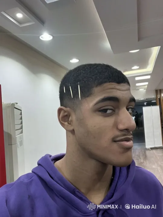 Young Man Showcases Unique Haircut and Smokes Calmly – AI Generated Video | Hailuo AI