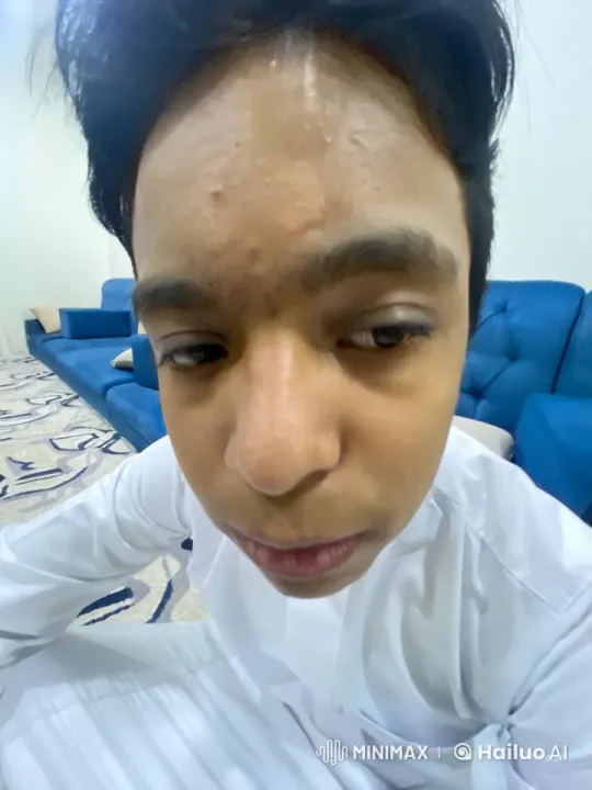 Young Man Contemplates in Stillness with a Cigarette – AI Generated Video | Hailuo AI