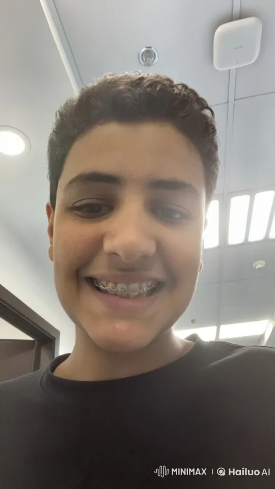 Young Person with Braces Smokes Indoors – AI Generated Video | Hailuo AI