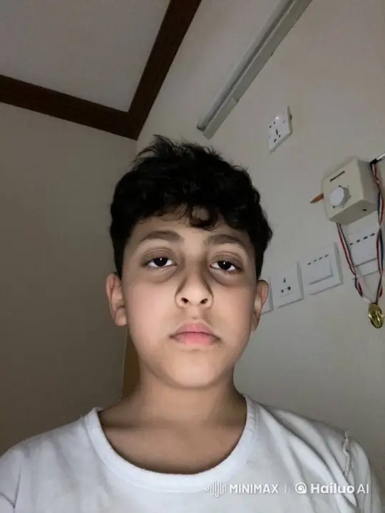 Boy's Frustration Leads to Wall-Punching Incident – AI Generated Video | Hailuo AI