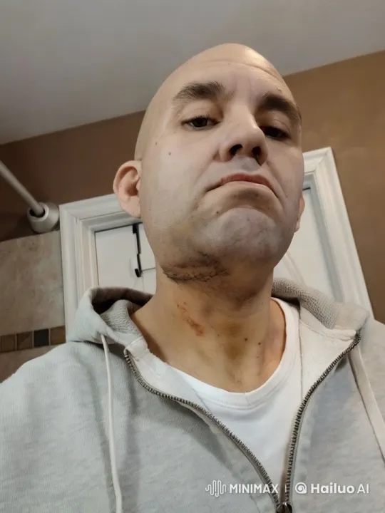 Man's Jaw Incision Leaks Black Liquid and Worms – AI Generated Video | Hailuo AI
