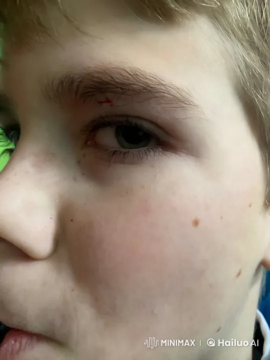 Venom Transformation: Boy's Face Turns Alien Symbiote – AI Generated Video | Hailuo AI