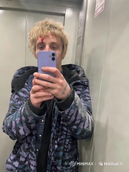 Young Man Takes Selfie in Elevator with Wound – AI Generated Video | Hailuo AI