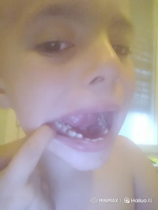 Young Boy Hits Sister Over Candy, She Cries – AI Generated Video | Hailuo AI