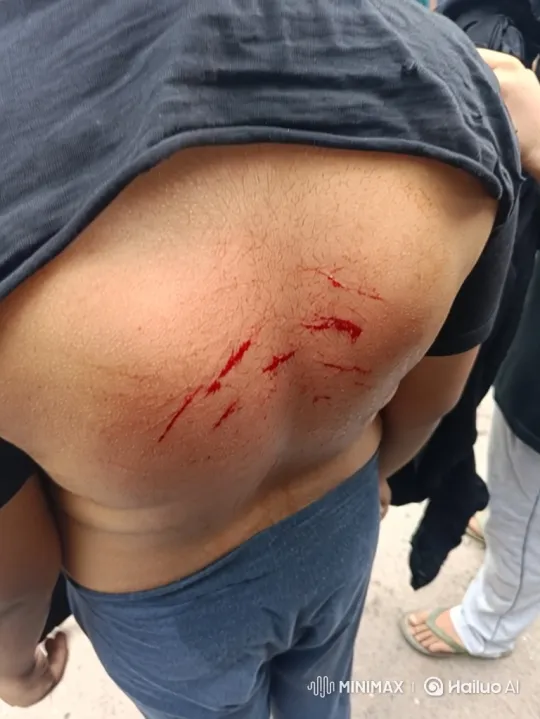 Mysterious Scratches and Blood Manifest on a Person's Back – AI Generated Video | Hailuo AI