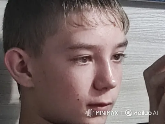 Young Man's Face Horrifically Transforms – AI Generated Video | Hailuo AI